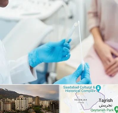 دکتر زگیل تناسلی HPV در زعفرانیه 