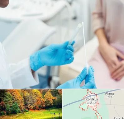 دکتر زگیل تناسلی HPV در کردکوی