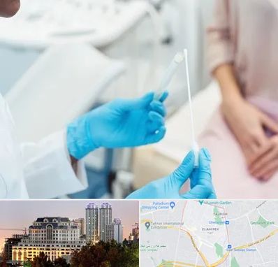 دکتر زگیل تناسلی HPV در فرشته 