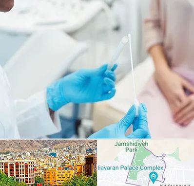 دکتر زگیل تناسلی HPV در نیاوران 