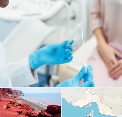 دکتر زگیل تناسلی HPV در هرمزگان