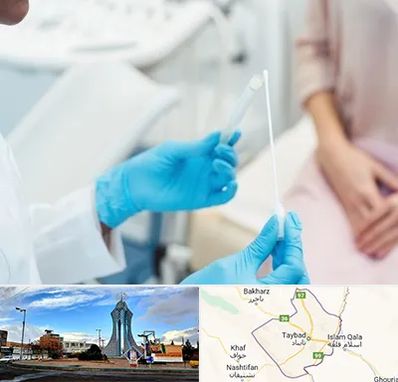 دکتر زگیل تناسلی HPV در تایباد