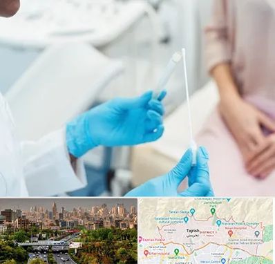 دکتر زگیل تناسلی HPV در منطقه 1 تهران 