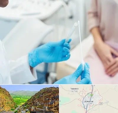 دکتر زگیل تناسلی HPV در کامیاران