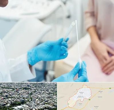 دکتر زگیل تناسلی HPV در شاهرود