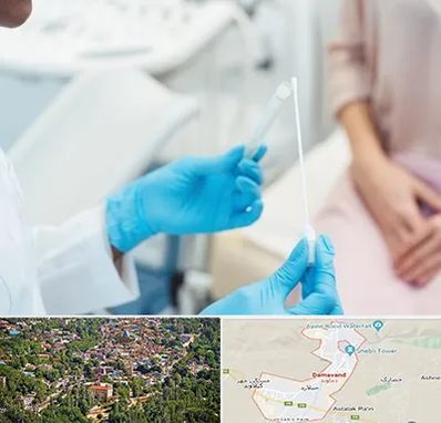 دکتر زگیل تناسلی HPV در دماوند