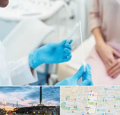 دکتر زگیل تناسلی HPV در منطقه 2 تهران 
