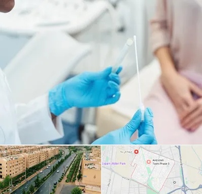 دکتر زگیل تناسلی HPV در فاز سه اندیشه