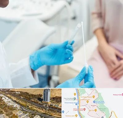 دکتر زگیل تناسلی HPV در خیابان نیایش شیراز 