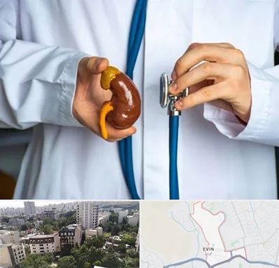 دکتر سرطان کلیه در اوین