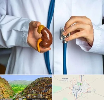 دکتر سرطان کلیه در کامیاران