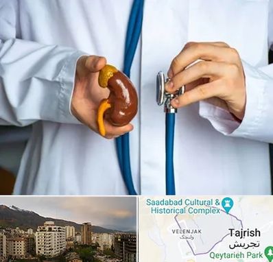 دکتر سرطان کلیه در زعفرانیه 