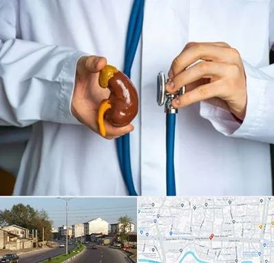 دکتر سرطان کلیه در ضیابری رشت 