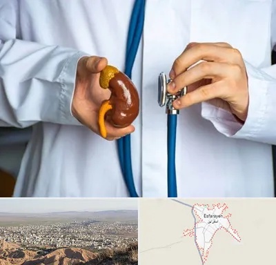 دکتر سرطان کلیه در اسفراین
