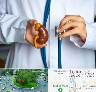 دکتر سرطان کلیه در تجریش 