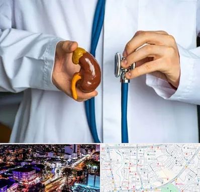 دکتر سرطان کلیه در منظریه رشت 