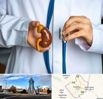 دکتر سرطان کلیه در تایباد