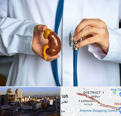 دکتر سرطان کلیه در فرمانیه 