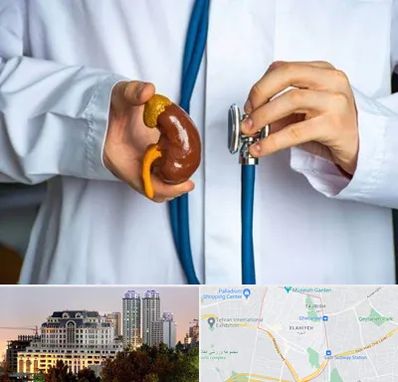 دکتر سرطان کلیه در فرشته 