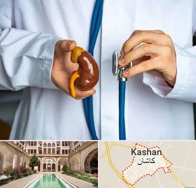دکتر سرطان کلیه در کاشان