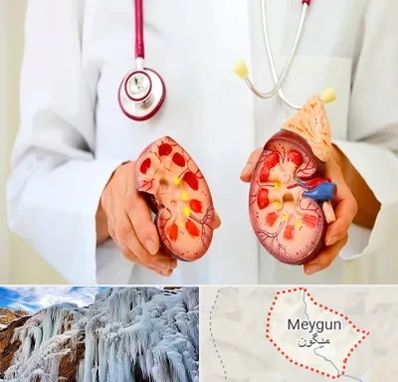 دکتر سنگ کلیه در میگون
