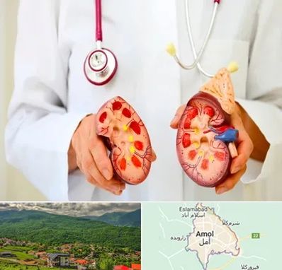 دکتر سنگ کلیه در آمل