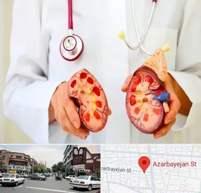 دکتر سنگ کلیه در خیابان آذربایجان
