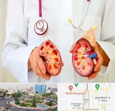 دکتر سنگ کلیه در ونک 