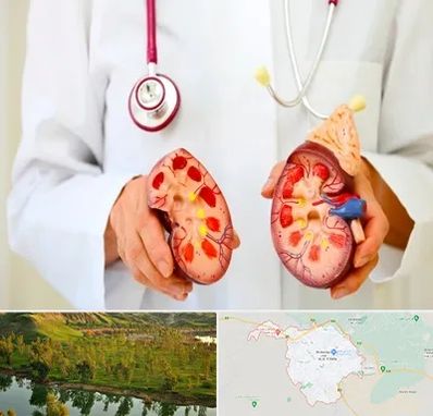 دکتر سنگ کلیه در بهبهان
