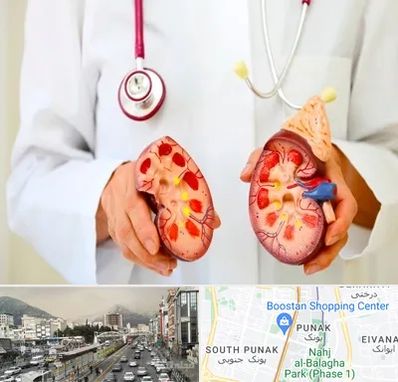 دکتر سنگ کلیه در پونک 