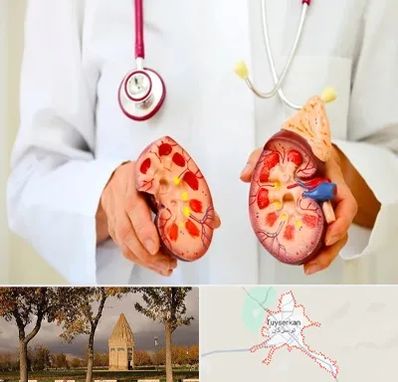 دکتر سنگ کلیه در تویسرکان