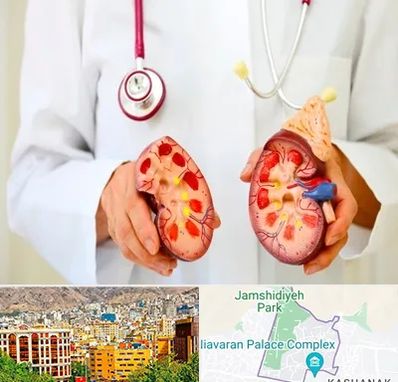 دکتر سنگ کلیه در نیاوران 