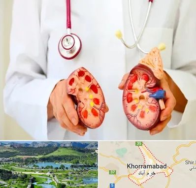 دکتر سنگ کلیه در خرم آباد