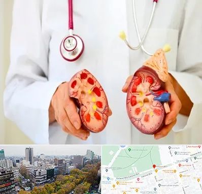 دکتر سنگ کلیه در بلوار کشاورز 