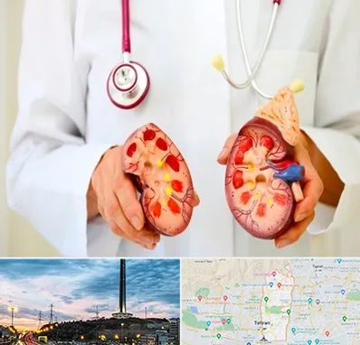 دکتر سنگ کلیه در منطقه 2 تهران 