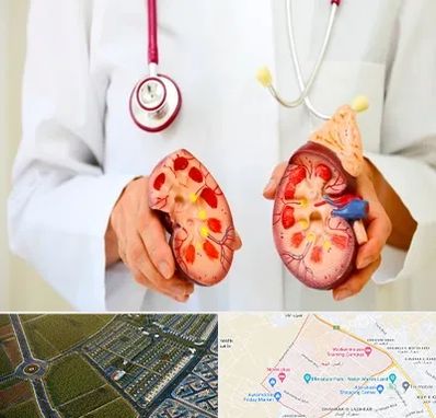 دکتر سنگ کلیه در الهیه مشهد 