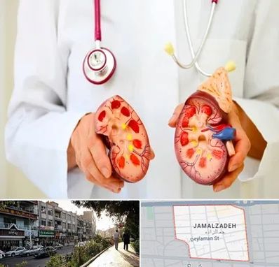 دکتر سنگ کلیه در خیابان جمالزاده