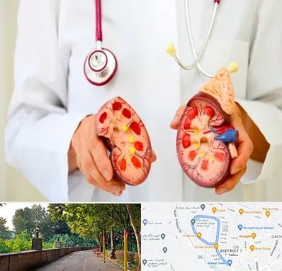 دکتر سنگ کلیه در فلکه گاز رشت 