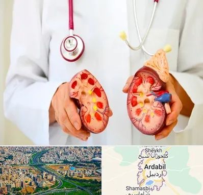دکتر سنگ کلیه در اردبیل
