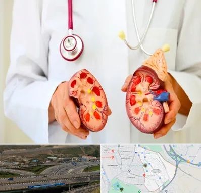 دکتر سنگ کلیه در یاغچیان تبریز