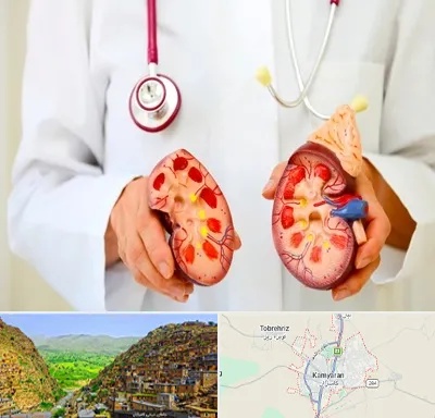 دکتر سنگ کلیه در کامیاران