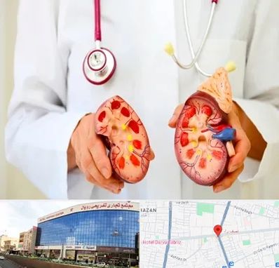 دکتر سنگ کلیه در نصف راه تبریز