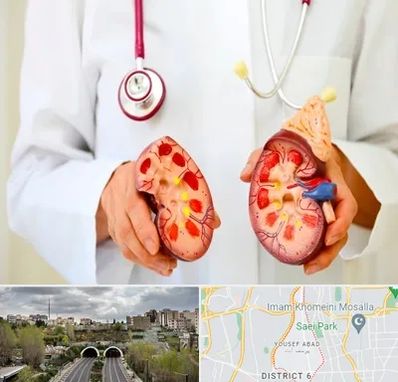 دکتر سنگ کلیه در یوسف آباد 