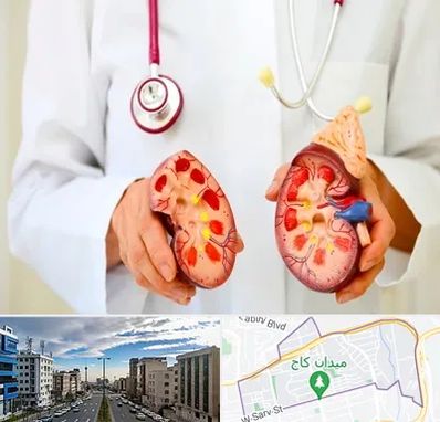 دکتر سنگ کلیه در سعادت آباد 