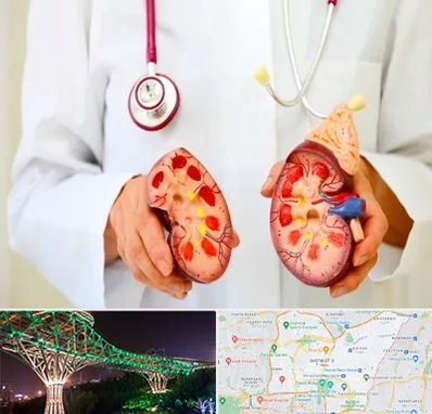 دکتر سنگ کلیه در منطقه 3 تهران 