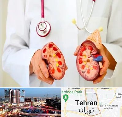 دکتر سنگ کلیه در صادقیه 