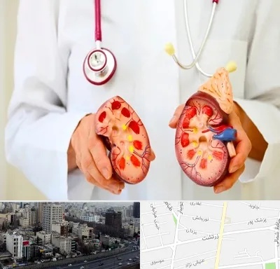 دکتر سنگ کلیه در زرتشت