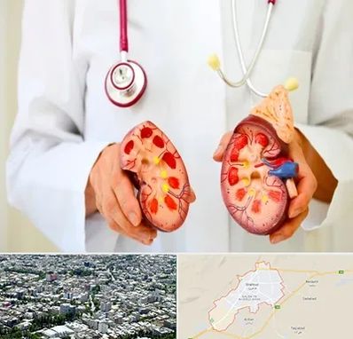 دکتر سنگ کلیه در شاهرود