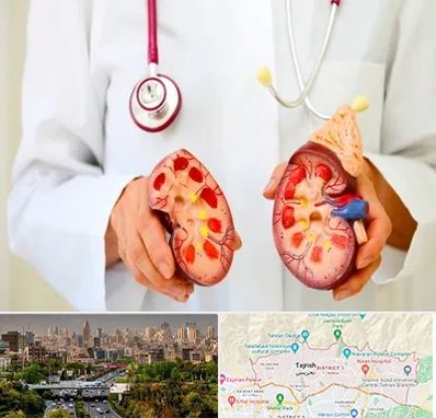 دکتر سنگ کلیه در منطقه 1 تهران 