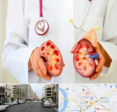 دکتر سنگ کلیه در زیتون کارمندی اهواز 